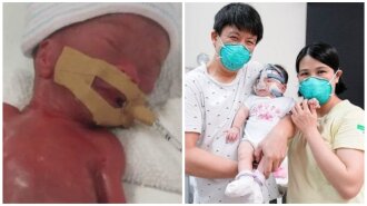 В Сингапуре из больницы выписали девочку, которая при рождении весила 212 граммов: как она выглядит сейчас (ФОТО)