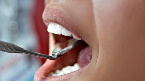 Как снять зубную боль: известный стоматолог дал надежный совет