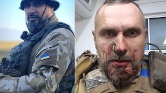 Олег Сенцов після артобстрілу