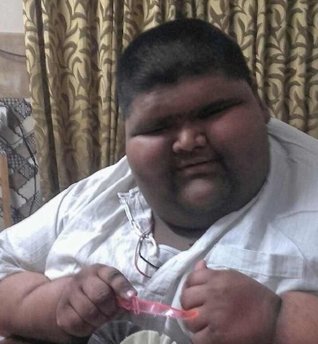 Михир Джаин — один из самых толстых детей в мире, похудел