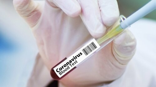 В Україні виявлено майже 10 тисяч випадків захворювання коронавірусом