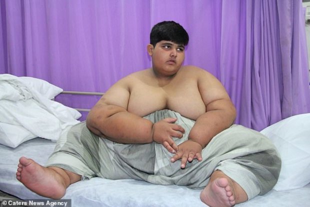 Мохаммед Арбрар — самый толстый мальчик в мире