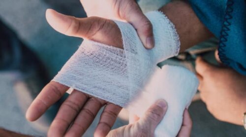 Як обробити рани від уламків та ран під час ударної хвилі: інструкція від лікарів