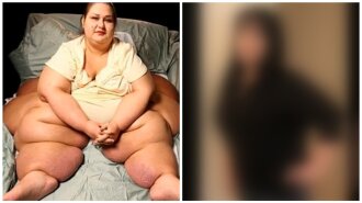 Как выглядит самая толстая женщина в мире, которая похудела на 400 кг: невероятные фото "ДО" и "ПОСЛЕ"