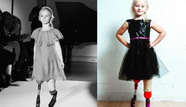 Девочка с ампутированными ногами строит карьеру в модельном бизнесе