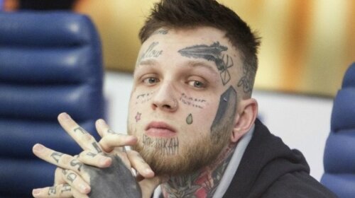 Крізь нестерпний біль: син Олени Яковлевої почав зводити татуювання з обличчя (ФОТО)