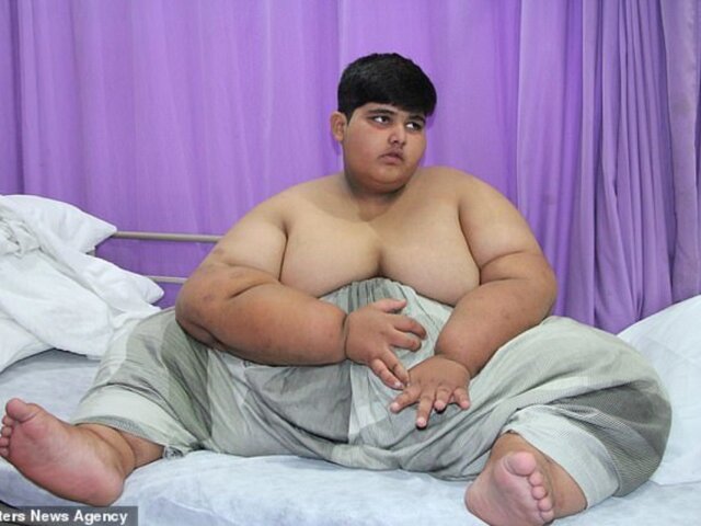 Мохаммед Арбрар — самый толстый мальчик в мире