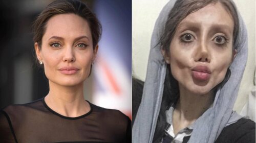 Дівчина, яка мріяла стати схожою на Анджеліну Джолі: як вона виглядає зараз