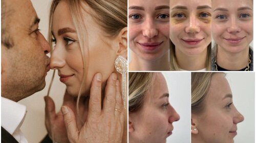 Жена Павлика показала, как изменилось ее лицо после ринопластики носа: ты ахнешь, когда увидишь Репяхову (фото)