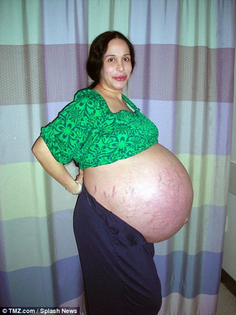 женщина беременная восьмерняшками
