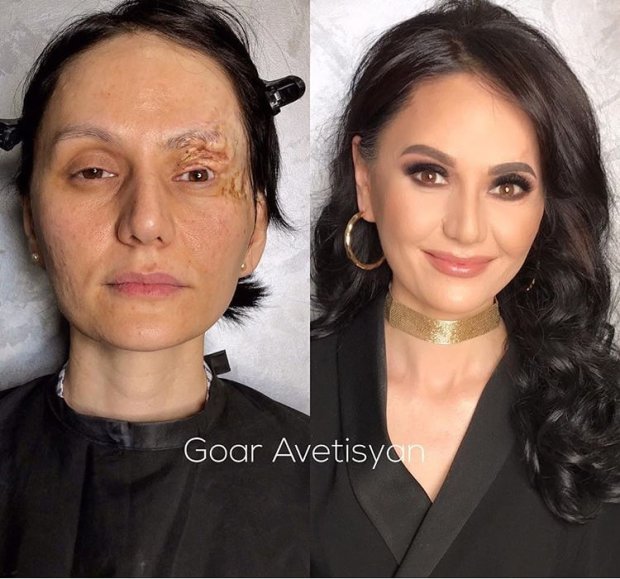 Гоар Аветисян меняет внешность женщины с «трагедией на лице»
