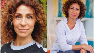 53-летняя Матвеева показала, как изменилось ее лицо сразу после омоложения: фото до и после