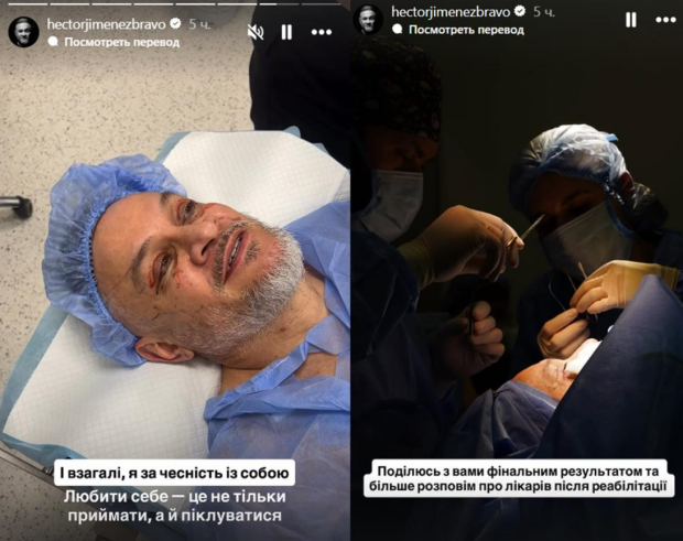 Эктор Хименес-Браво сделал пластическую операцию