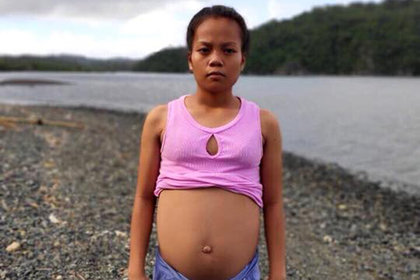 Местные жители решили, что девочка забеременела от рыбы