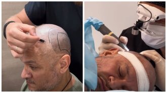 Ектору Хіменесу-Браво провели операцію, через яку він поголився налисо: подробиці