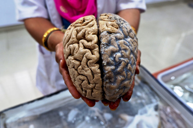 Ученым впервые удалось оживить мертвый мозг
