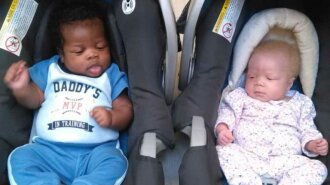 4 года назад женщина родила близнецов с разным цветом кожи: как сейчас выглядят дети (ФОТО)