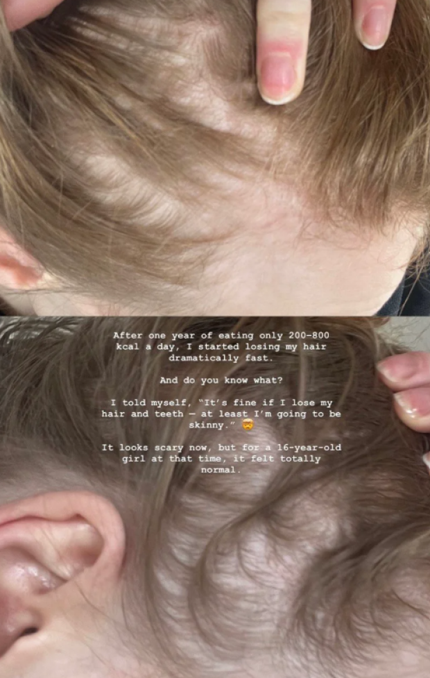 Скрін публікації Насті Юзьвак