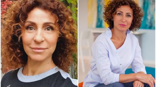 53-річна Матвєєва показала, як змінилося її обличчя відразу після омолодження: фото до і після
