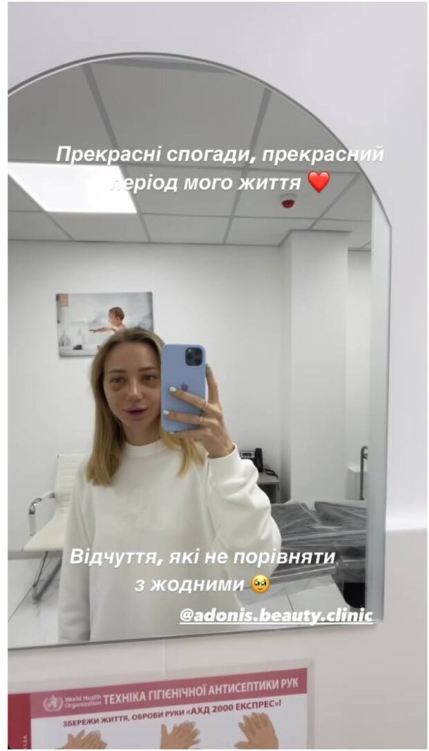 Реакция Екатерины Репяховой на свой новый нос