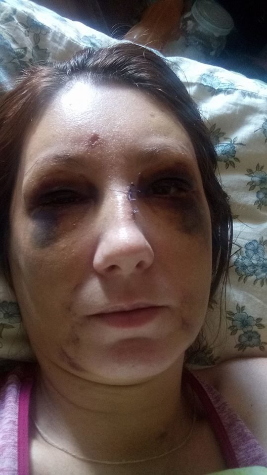 Женщина после избиения