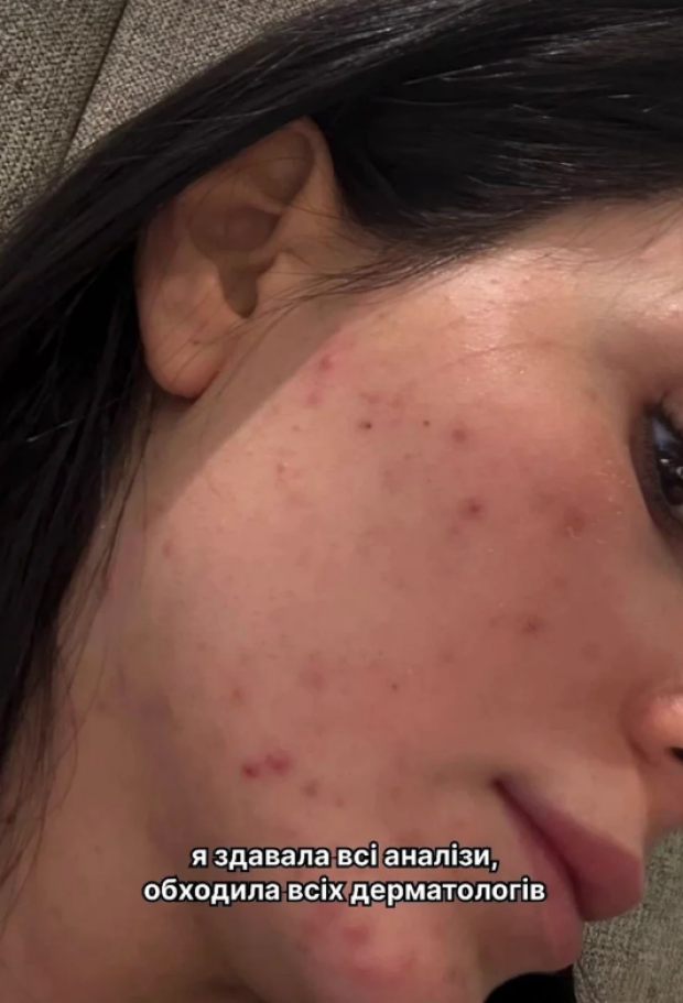 Анна Трінчер без макіяжу