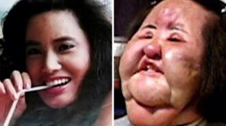 ТОП-11 знаменитостей, которые изуродовали свое лицо пластикой: ФОТО до и после