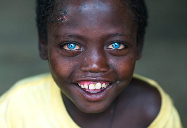 Темношкірий з блакитними очима