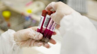 Вчені назвали найбільш "небезпечну" групу крові
