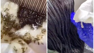 Такого еще не видели: эксперты спасли девочку, волосы которой кишели "зоопарком" из вшей (ВИДЕО)