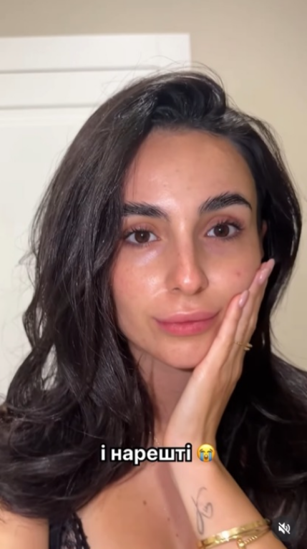 Анна Трінчер без макіяжу про проблемну шкіру