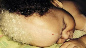 В Бразилии родился малыш с необычной внешностью: как он выглядит спустя 6 лет (ФОТО)