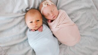 Через рідкісну аномалію близнюки народилися з 15-ю переломами