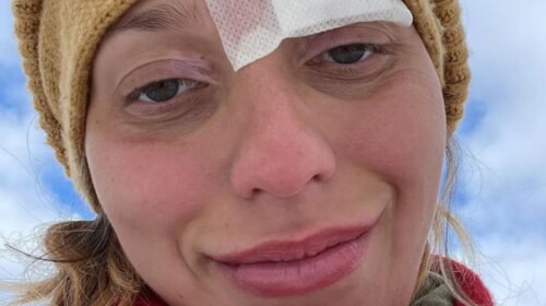 Ворогу не побажаєш: глибоко вагітна Тодоренко розповіла про важку хворобу