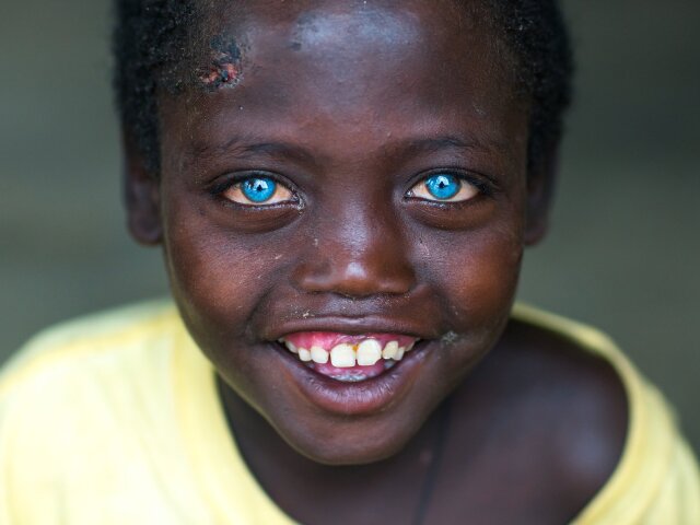 Темношкірий з блакитними очима