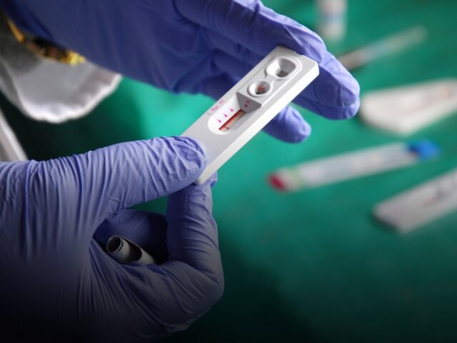 Test HIV at Pomerini in Tanzania — Africa