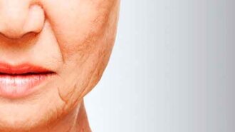 Как убрать брыли на лице и обвисшие щеки: помогут упражнения Евгении Баглык (ВИДЕО)