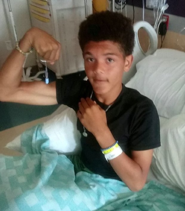 У 13-річного хлопчика прицільно вдарила блискавка, але він вижив і розповів про свої відчуття