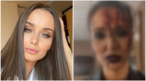 В Сети появилось видео истекающей кровью Ксении Мишиной:  что произошло с экс-холостячкой