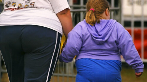 Топ-7 пугающих фактов об ожирении, которые заставят следить за питанием