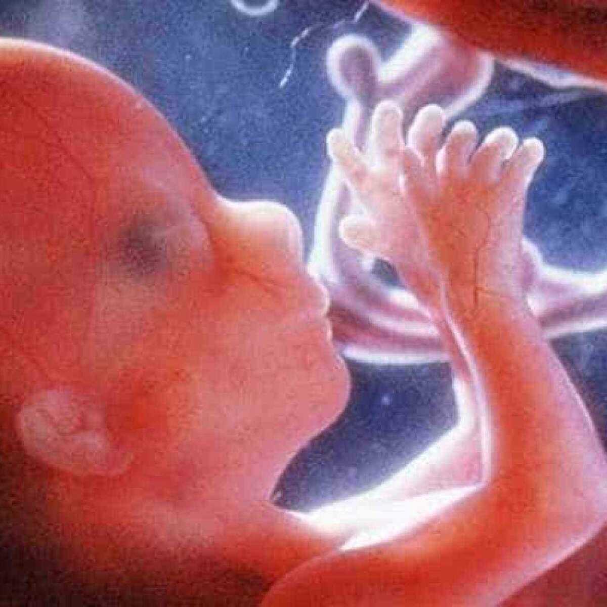 Эмбрион На 12 Неделе Беременности Фото
