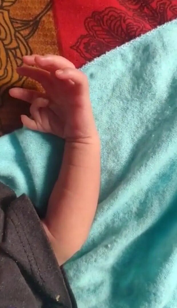 "Реинкарнация богини": девочка родилась с 26 пальцами (ФОТО)