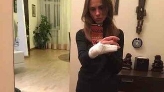 В Киеве патрульные полицейские сломали девушке руку (фото, видео)