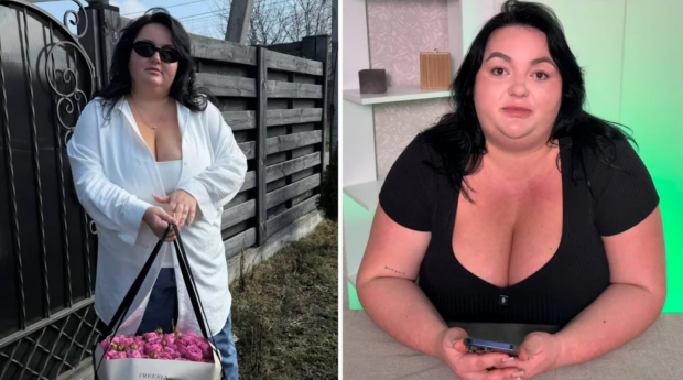 Анастасия Ткаченко до и после операции по уменьшению желудка