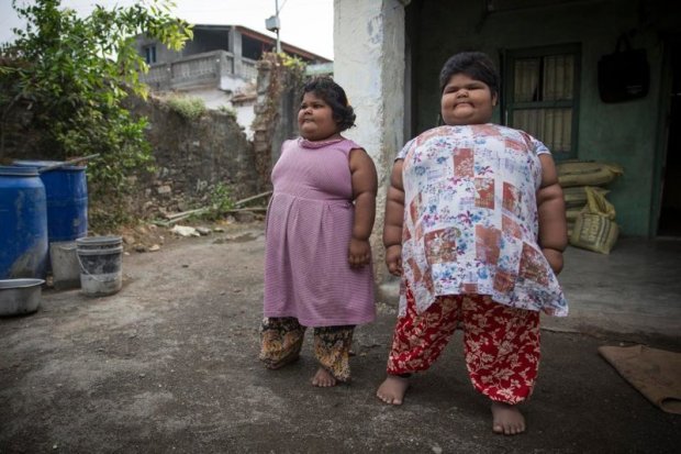 Самые толстые сестры в Индии
