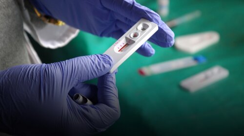 Test HIV at Pomerini in Tanzania — Africa