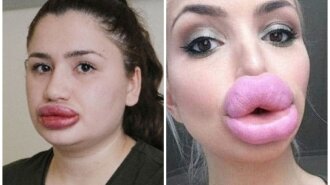 Антипримеры: ТОП-14 девушек, которым не повезло с увеличением губ (ФОТО)