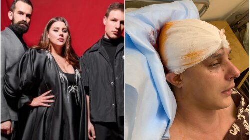 Проломили череп и повредили глаз: на автора песен группы KAZKA напали в в подъезде собственного дома – подробности происшествия