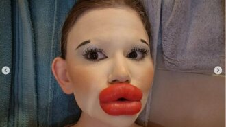 Девушка с самыми большими в мире губами ошарашила видом без макияжа (ФОТО)