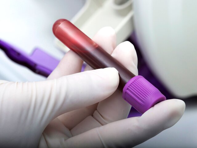 Медики составили список продуктов для повышения гемоглобина